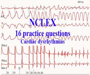 Nclex 16 Practice Questions About Cardiac Dysrhythmias