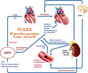 Nclex 69 Practice Questions About Cardiac Mi And Hf Part 1